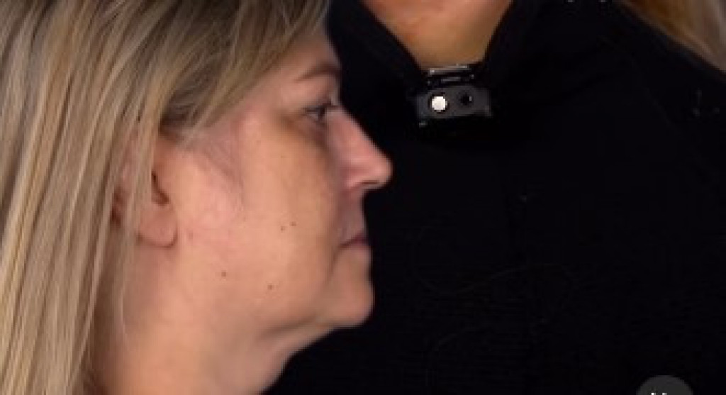 Sa 52 godine, Lana je želela da ponovo izgleda kao sa 18: Hirurgu je donela jednu jedinu fotografiju. Pogledajte njen novi izgled (UZNEMIRAVAJUĆI VIDEO)