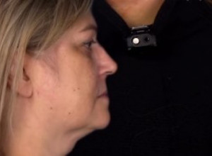 Sa 52 godine, Lana je želela da ponovo izgleda kao sa 18: Hirurgu je donela jednu jedinu fotografiju. Pogledajte njen novi izgled (UZNEMIRAVAJUĆI VIDEO)