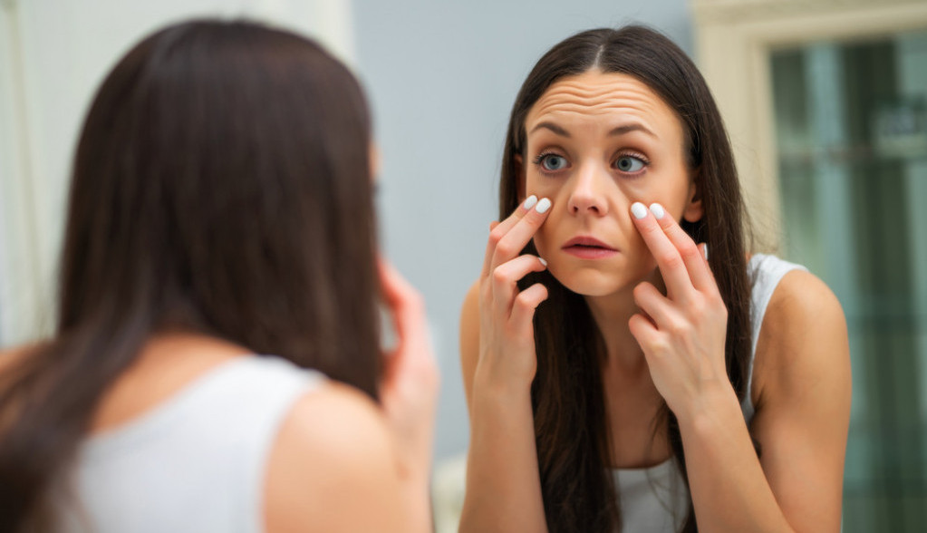 Kako ukloniti podočnjake: Ublažite tamne kese ispod očiju jednostavnim trikovima