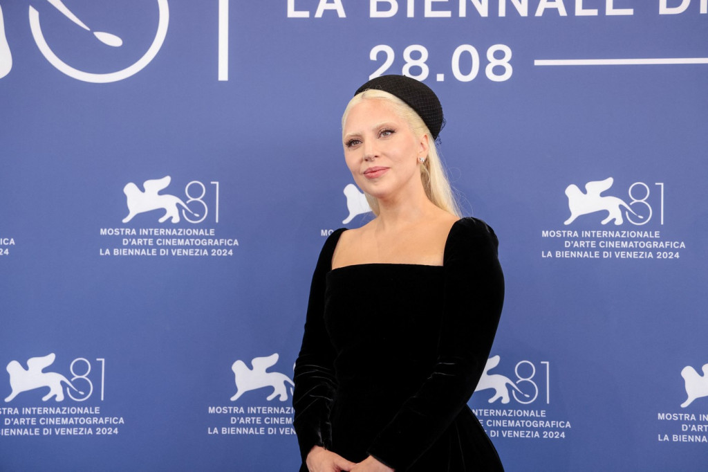 ,,Uradila sam to bez bola": Lejdi Gaga otkrila kako se izborila protiv bolesti kojoj nema leka, ovo je bilo ključno