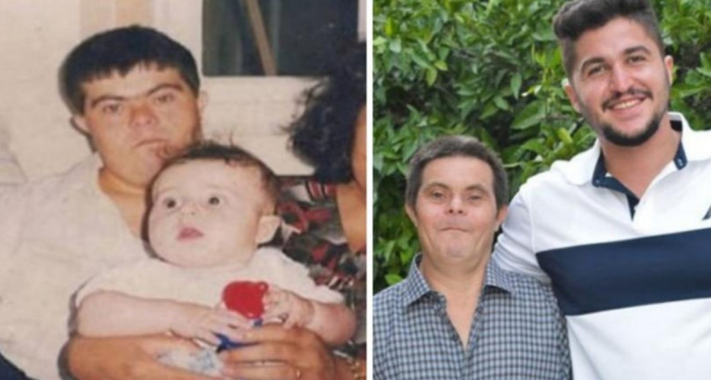 Dokaz da ljubav prevazilazi sve: Otac sa Daunovim sindromom odgajio uspešnog doktora