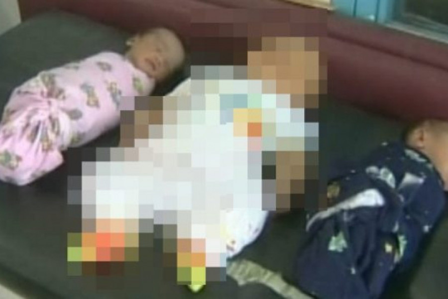 Lekari nikada nisu videli nešto slično: Mama je rodila trojke, ali se jedna beba potpuno razlikovala od ostalih