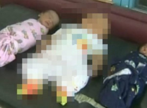 Lekari nikada nisu videli nešto slično: Mama je rodila trojke, ali se jedna beba potpuno razlikovala od ostalih
