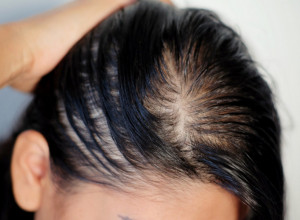 Nervira vas opadanje kose? Evo kako da je ojačate za čas, prirodni sastojci su njeni najbolji prijatelji