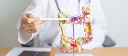 Lekar otkrio šta jede za bolju probavu: Ova jeftina namirnica pospešuje zdravlje creva, a iznenadićete se kad čujete o kojoj je reč