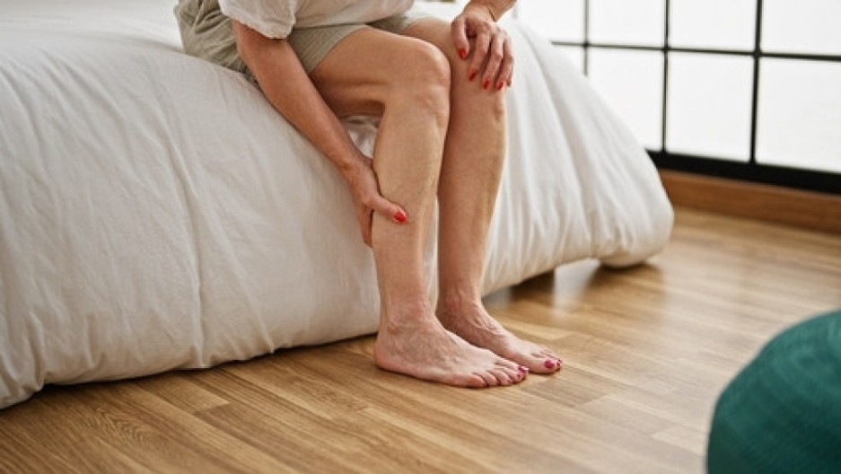 Povišen holesterol možete prepoznati gledajući svoje noge: Ova promena je znak da imate ozbiljan problem