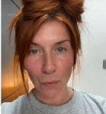 "Imam 45 godina i nijednu boru, samo zbog kore ovog voća“: Efikasanija od seruma, a koža izgleda zategnutije i mlađe