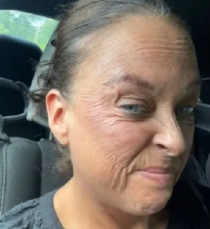 "Izgledam kao da imam 80 godina": Lisa odlepila za kozmetičkim preparatom, a cenu je platila njena lepota - "dobila sam rane i žuljeve!"