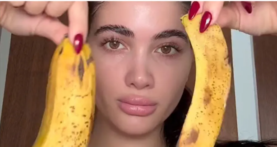 Kora od banane kao prirodni botoks? Dermatolozi zgroženi trendom koji je zaludeo svet, upozoravaju šta se može desiti