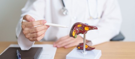 Oslobodiće se ogromna količina kamenja i sve će se izbaciti kroz stolicu: Kako očistiti jetru i bubrege, ovaj proces nije lako izdržati, ali daje rezultate