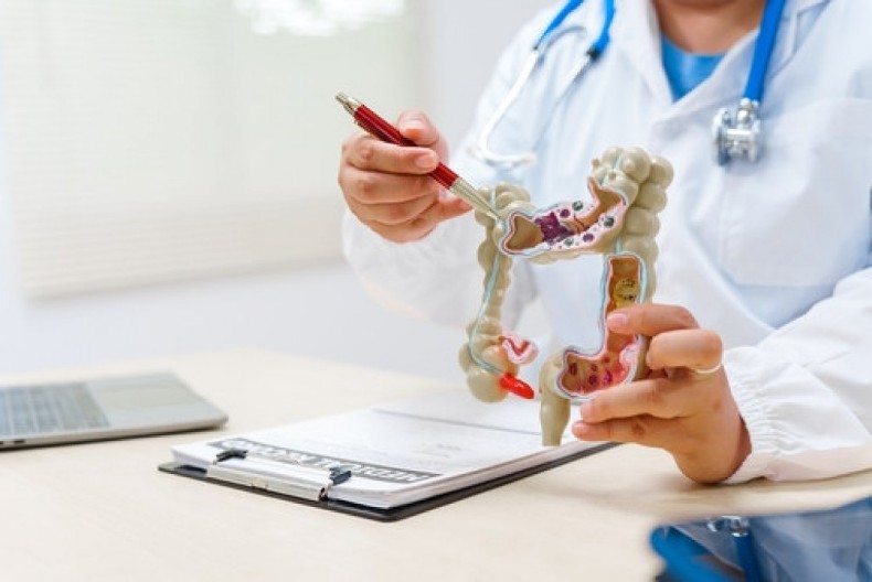 Gastroenterolog ove 3 namirnice izbegava po svaku cenu: Jako su opasne za creva i štetne po naše zdravlje