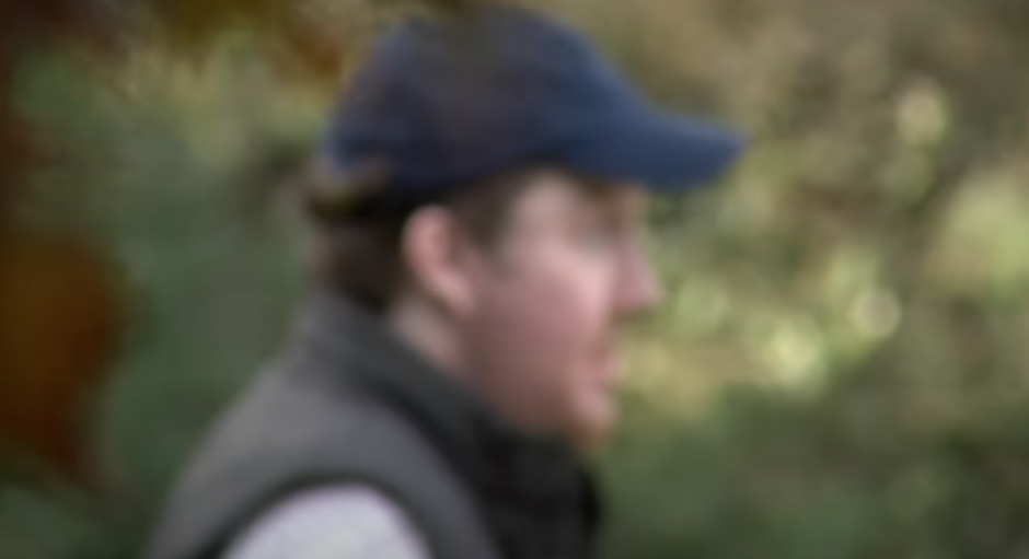 Živeo je bez lica 11 godina: U mladosti je doneo odluku koja ga je skupo koštala, ali sada je dobio novu šansu i izgleda ovako