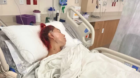 Ne progovara, jede na slamčicu: Rijaliti zvezda u mukama zbog ove operacije
