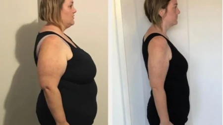 Imala je 127 kilograma i godinama krila da ne može da veže pojas u avionu: Uradila je jednu stvar i izgubila čak 62 kilograma