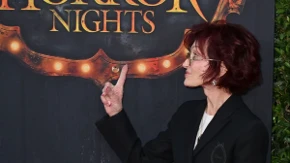 Zatezanje joj se obilo o glavu: Žena muzičke legende se pokajala zbog estetskog zahvata