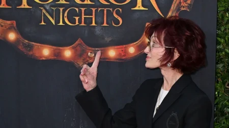Zatezanje joj se obilo o glavu: Žena muzičke legende se pokajala zbog estetskog zahvata