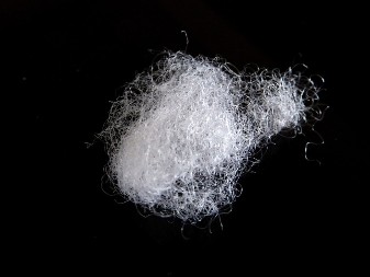 Imate vunu u pupku? Eksperti konačno objasnili čudnu pojavu, otkrili šta se sve u njemu nalazi