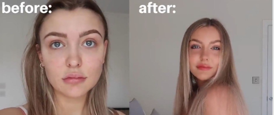 Žali bože para: Rešila sam da se doteram za leto i 400.000 dinara kasnije ovo su rezultati