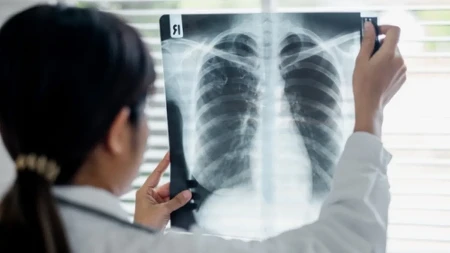 Ne ignorišite simptome: Kardiolozi otkrivaju kako da prepoznate krvni ugrušak pre nego što bude kasno