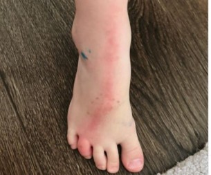 Sin je došao iz vrtića, skinuo čarape i videla sam crvenu liniju: Delovalo je bezazleno, a minuti su nas delili od tragedije