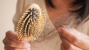 Tu se prvo oćelavi: Ovaj deo glave je posebno krizan, ali eksperti kažu da jedan trik pomaže