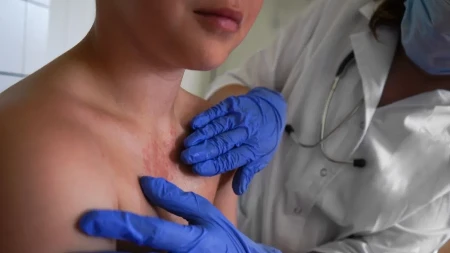 Može izazvati infekcije grla, kože, mozga, opasna je haos: Ovo su simptomi bolesti koja napada najčešće decu, 