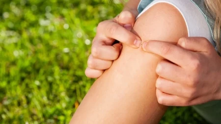 Lekari alarmiraju: Ova česta greška pri vađenju krpelja može biti opasna