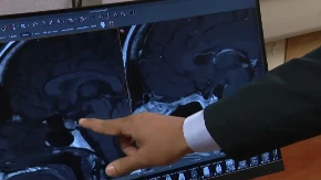 Mislila da je do stresa: Česti simptomi krili su opaku bolest, a ona kaže da je ovo bio najgori deo