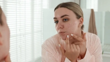 Istina o bubuljicama: Da li vam lice zaista otkriva zdravstveno stanje?