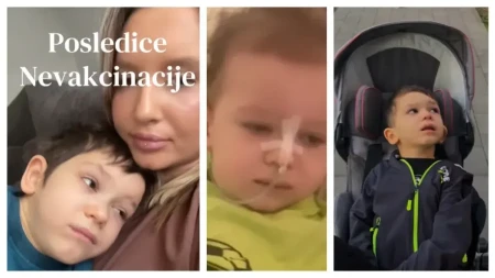 „Moj sin ne može da sedi, pomera vrat, zarazio se nevakcinisan“ Male boginje su Nemanji uništile detinjstvo