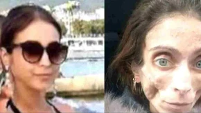 Htela da udovolji mužu, pa uništila sebi život: Jana je smršala na 22 kilograma, a on je na kraju ostavio