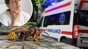 "Mislila sam da neću preživeti" Žena opisala jezive trenutke posle uboda stršljena: Za nekoliko sekundi ostala sam bez vazduha, a onda je počela prava borba za život