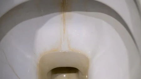 Ama uništava skoreli kamenac, skida sve crno, dno će se beleti: Kako očistiti prljavu WC šolju, ovo stvarno radi