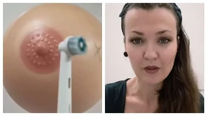Zapušen mlečni kanal može da dovede do mastitisa: Babica Maja Ljujić pokazala trik koji je mnogim mamama pomogao