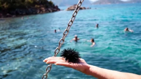 Najčešće ih ima u plićaku: Šta uraditi ukoliko stanete na morskog ježa