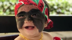 Sećate se Lune koja je rođena sa „Betmen maskom“ na licu? Vređali su je od prvog dana, rekli da je čudovište, a evo kako danas izgleda posle silnih operacija!