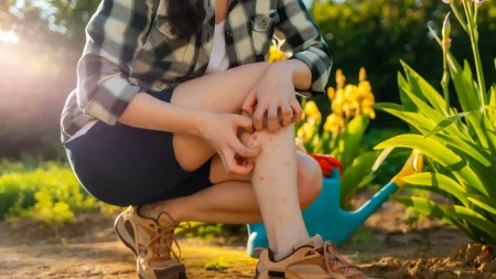 Virus Zapadnog Nila se širi Srbijom: 11 obolelih, kod 10 razvijen težak oblik, ovo su simptomi za hitnu reakciju