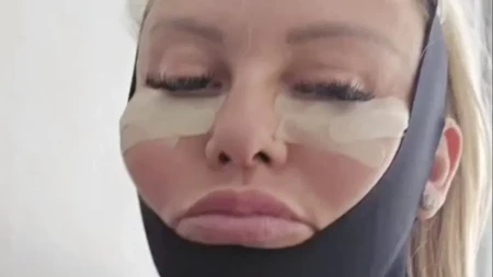 "Ja sam kao Frankeštajnova nevesta": Viktorija (41) potpuno je preoblikovala celo telo, uključujući i "intimu", evo kako sada izgleda