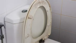Uklonite žute mrlje sa WC daske: Zaboravite na izbeljivač