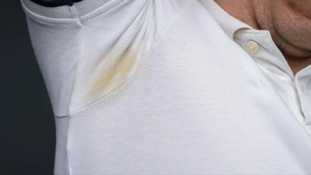 Žute fleke na beloj odeći nestaju zauvek: Trik sa 1 sastojkom koji imate u fioci