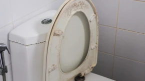 Čisti dasku od WC šolje bolje od varikine? Evo kako da od požutele dođete do sneg bele, bolje i od najjače hemikalije